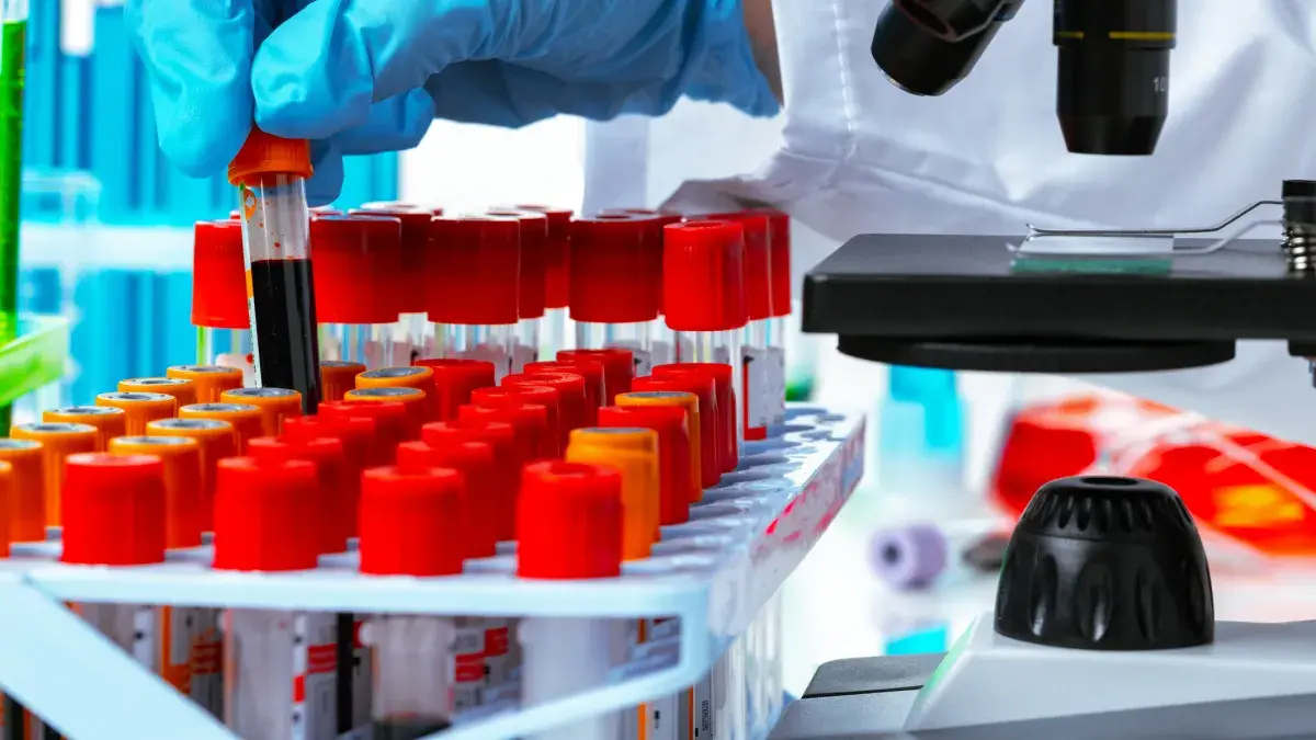 Close up of scientist handling blood samples in tubes next to a microscope