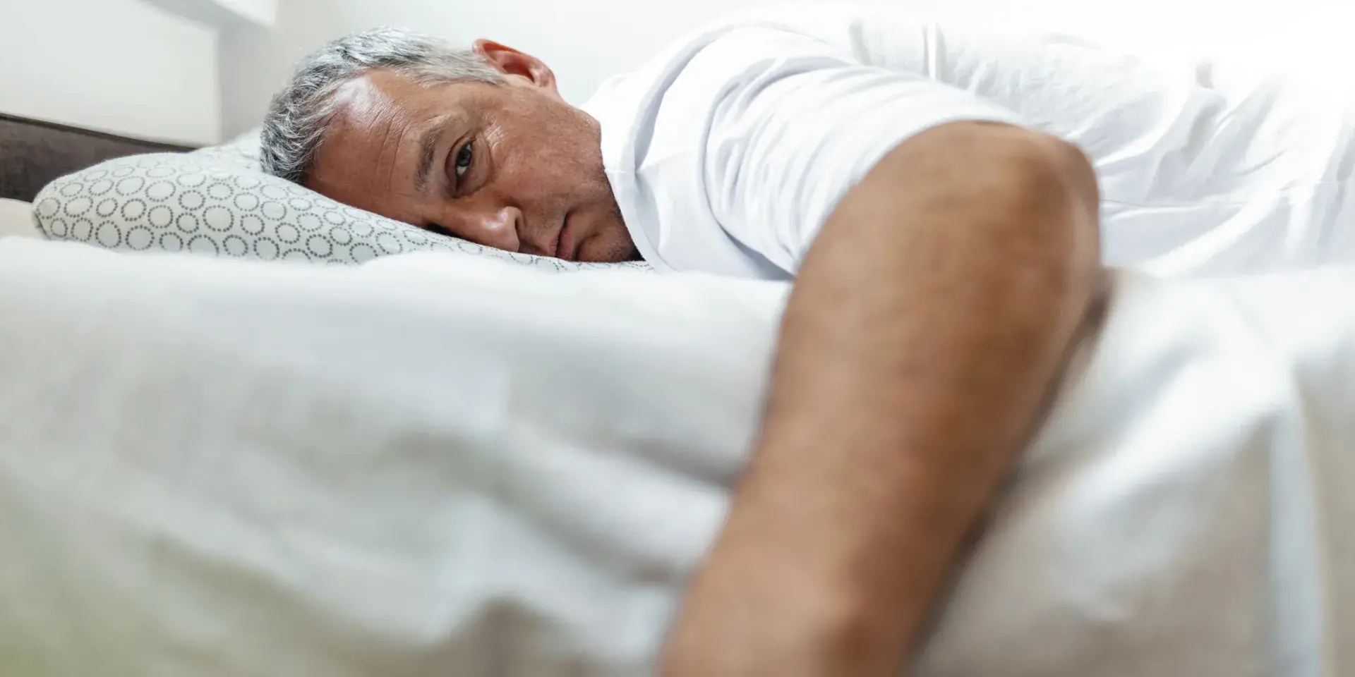White male lying in a bed looking tired