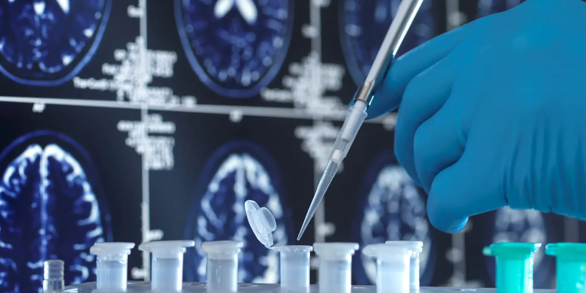 Close up photo of scientist pipetting into small tubes with brain scans in background