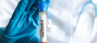 A health worker in a laboratory checks a hantavirus sample in a test tube